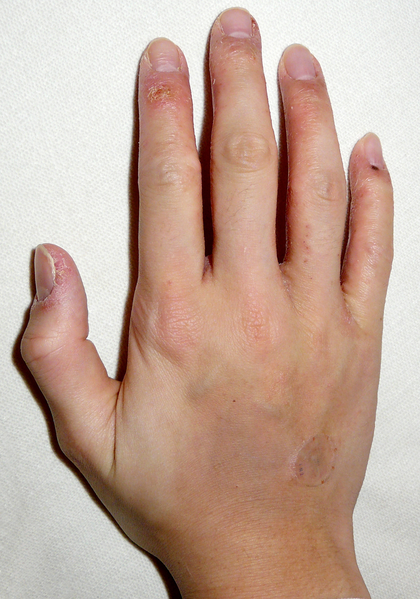Right Hand Nov 2008